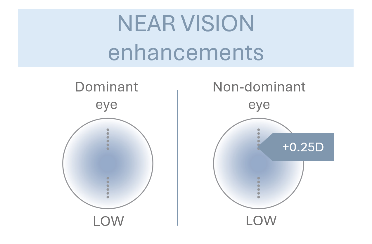 Near vision enhancement