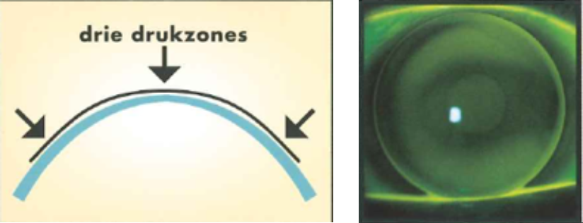 drie drukzones exact