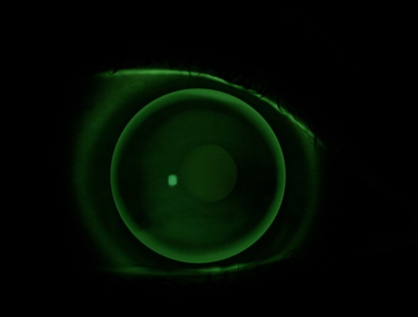 voorbeeld goede passing genius