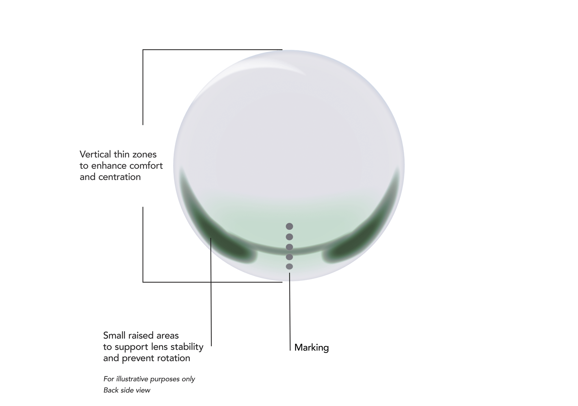 UpSide - Toric - All in One - Annotation